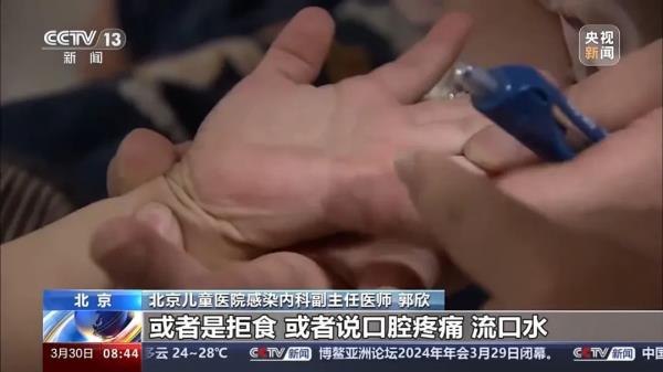 手足口病高发期将来临，出现哪些症状要及时就医？如何预防？