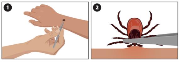 注意！这个“黑点”又来了，严重可致命