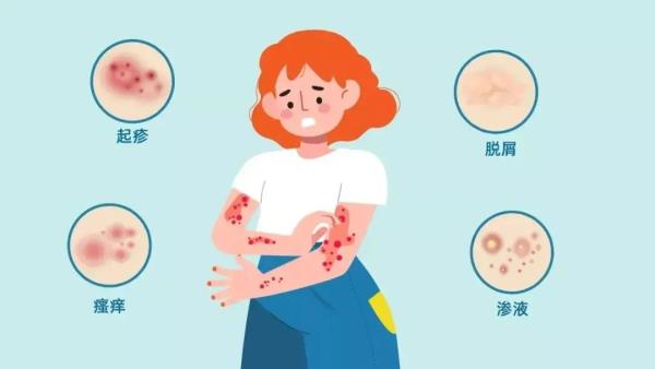 镇江人警惕！最近多发，严重可致命