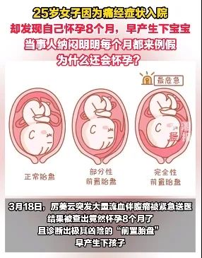 罕见！女子“痛经”入院，竟发现已怀孕8个月，早产生下宝宝