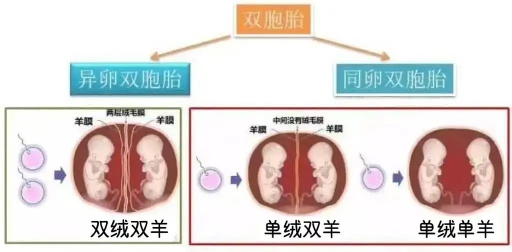 三胞胎同挤一“房间”,医院240天护航助孩子平安出生 三胞胎同挤一“房间”,医院240天护航助孩子平安出生