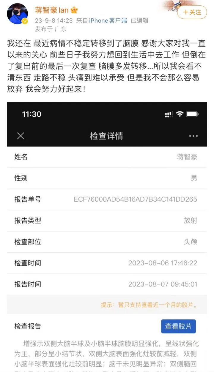 28岁男艺人一年前确诊肺癌晚期，今日再发声：坚持过来了