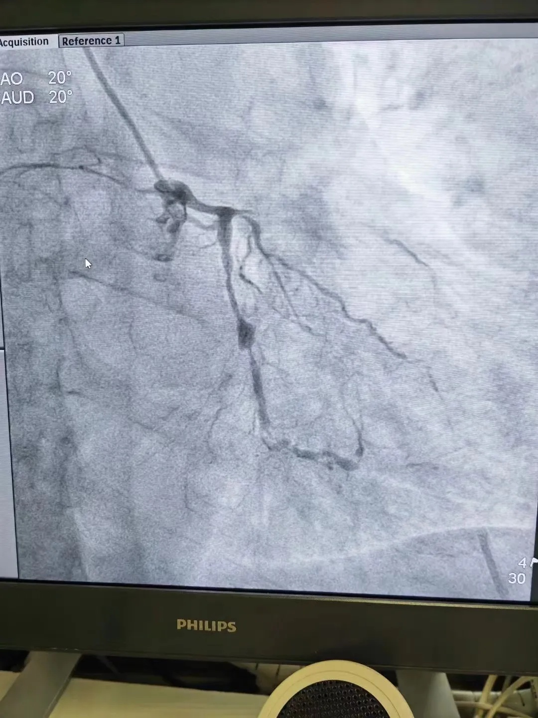 绍兴35岁男子确诊!医生连连感叹 绍兴35岁男子确诊!医生连连感叹