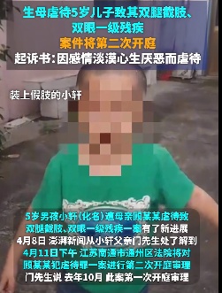 5岁男童被生母虐待致双腿截肢、眼睛残疾！有新进展→