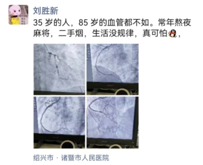 绍兴35岁男子确诊!医生连连感叹 绍兴35岁男子确诊!医生连连感叹