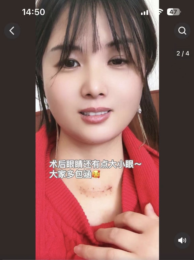 昔日“顶流”网红自曝患癌！警惕：这种癌逐渐年轻化