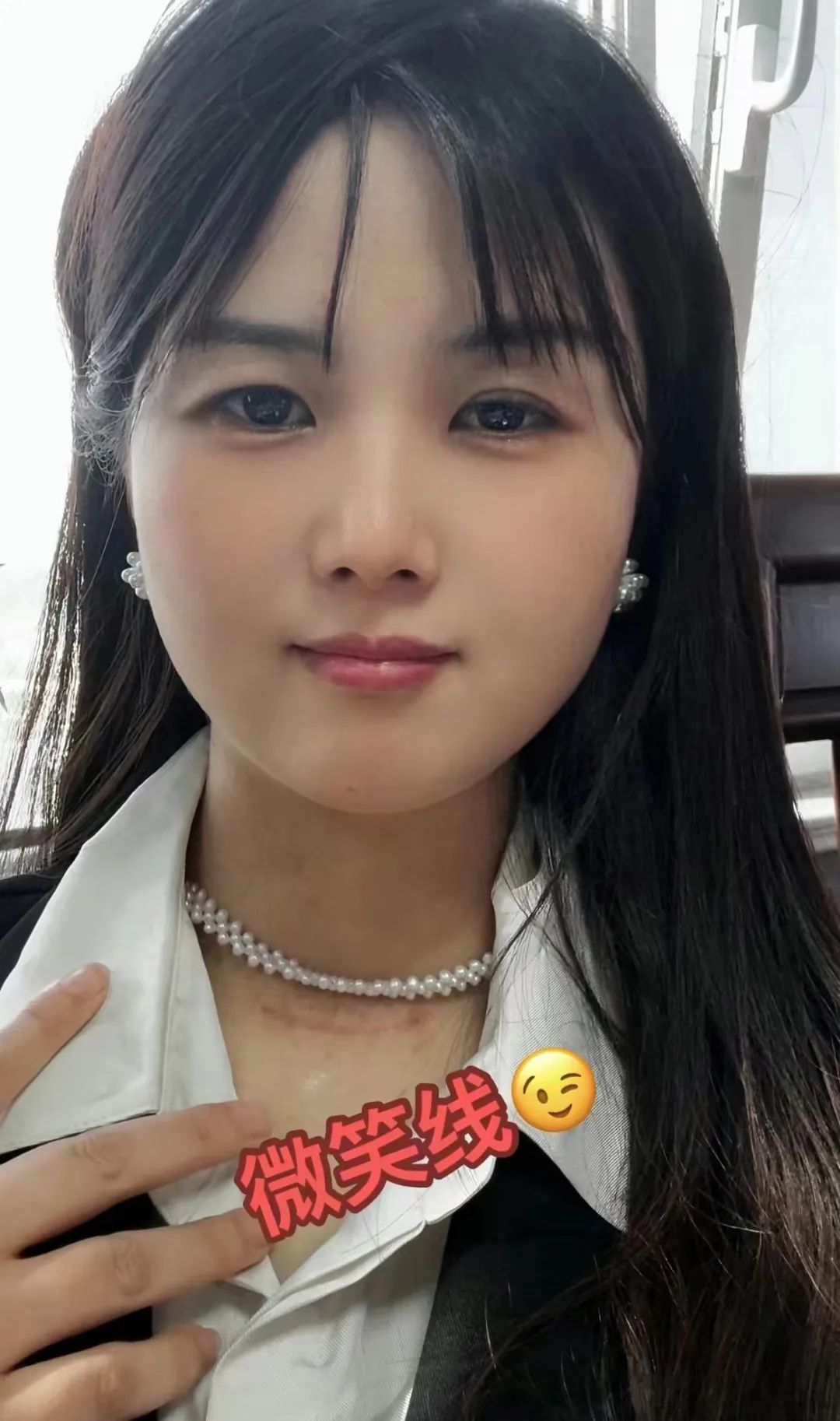 这病偏爱年轻人？拥有2000万粉丝的她自曝患癌！发病率逐年增长！