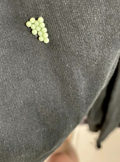 头皮发麻,别碰!一出现就是14颗?很多人衣服上都有… 头皮发麻,别碰!一出现就是14颗?很多人衣服上都有…
