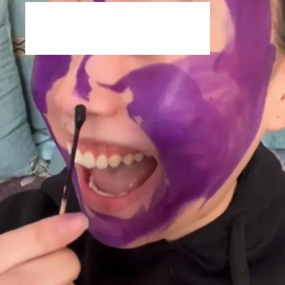 别再用了！你熟悉的这种“外伤神药”被淘汰了