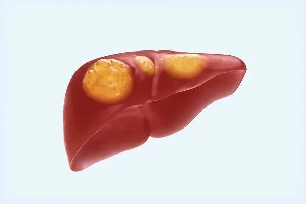 研究发现：45岁前有这个特征的人，多年后更易得癌！