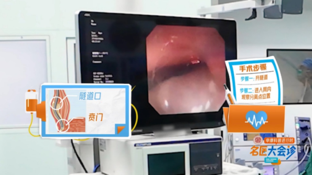 男子暴瘦！每次只能咽下一粒米？上海医生：这种病很痛苦