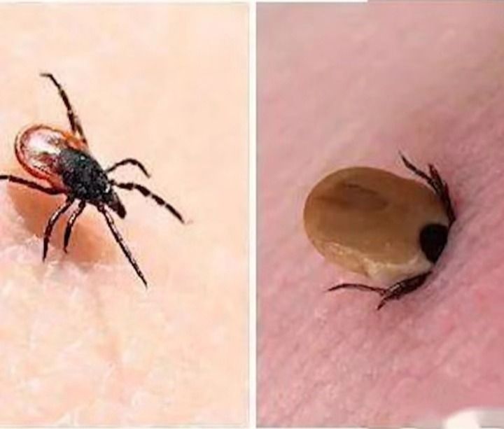 踏青出行，如何防蜱虫？