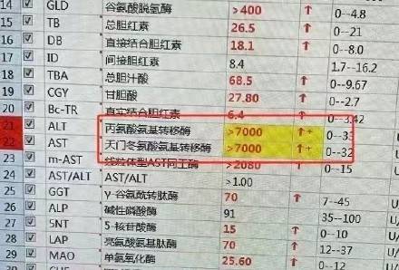 22岁女孩为维持80斤体重节食十年， 因重了5斤疯狂吃减肥药吃到肝衰竭