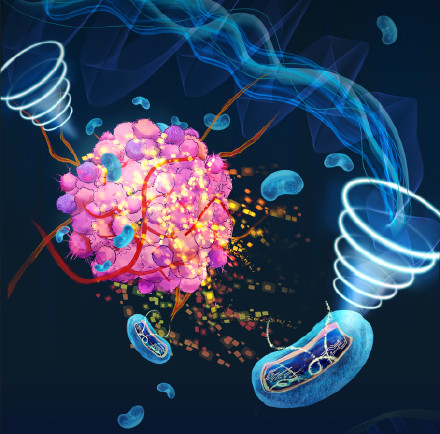 声遗传学技术可通过超声引爆肿瘤