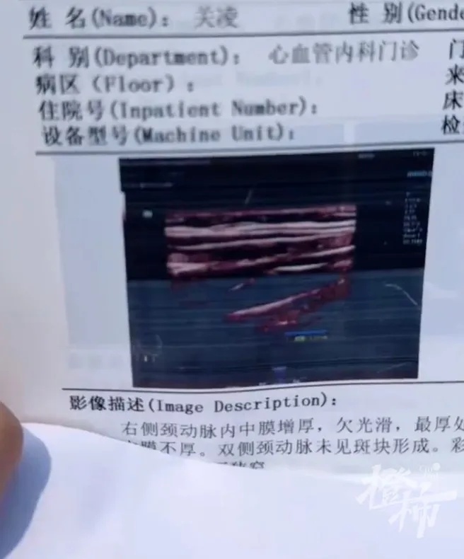 心脏超声检查报告单图片