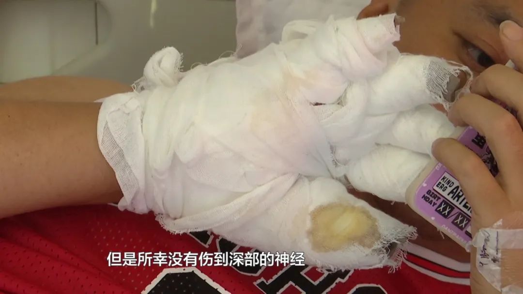 贵阳一男子摔倒后，口袋里的这个东西突然爆炸！手脚被炸伤……医生紧急提醒