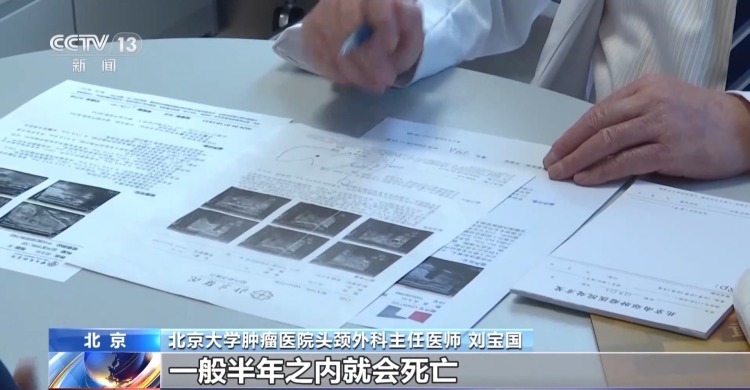 发病率上升却经常被忽视 关于甲状腺癌你要了解这些 发病率上升却经常被忽视 关于甲状腺癌你要了解这些