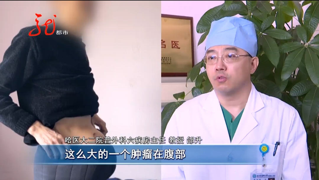 男子肚大像“怀孕”，竟是恶性肿瘤！