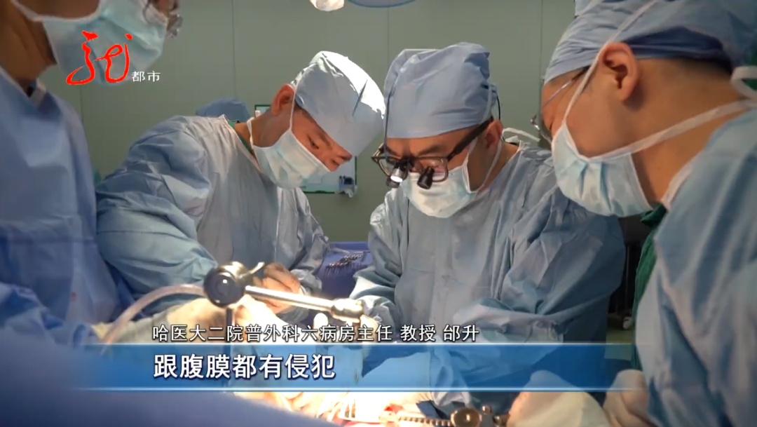 男子肚大像“怀孕”，竟是恶性肿瘤！