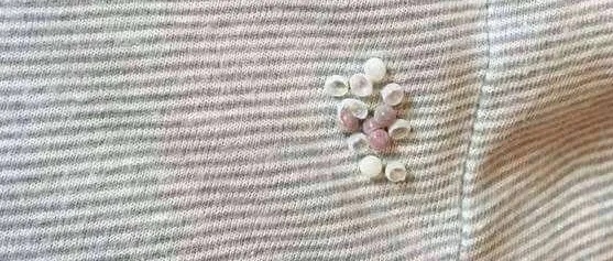 别碰!近期阳台上收衣服的时候,要小心了 别碰!近期阳台上收衣服的时候,要小心了