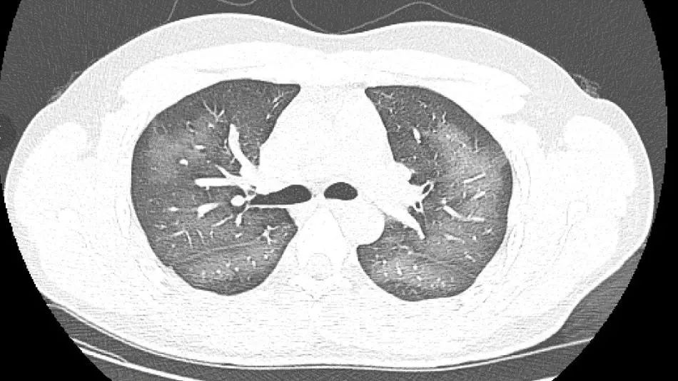 家里有这种夏天“神器”，千万别给孩子用！已有人白肺！