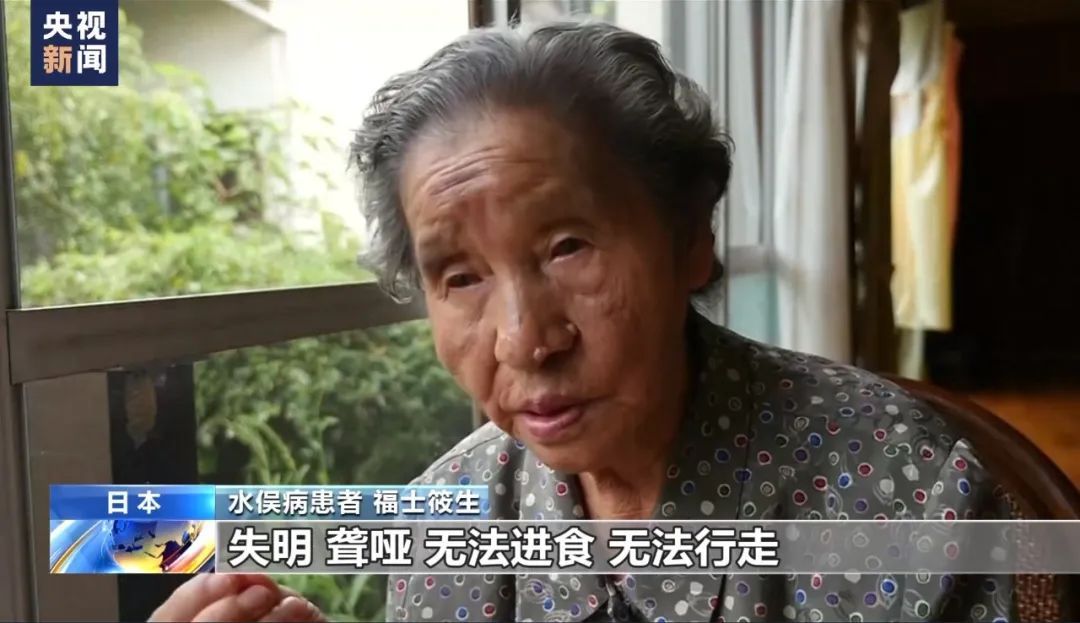 十分惨烈!感染者四肢扭曲抽搐,受害者多达3000人!日本最新判决→ 十分惨烈!感染者四肢扭曲抽搐,受害者多达3000人!日本最新判决→