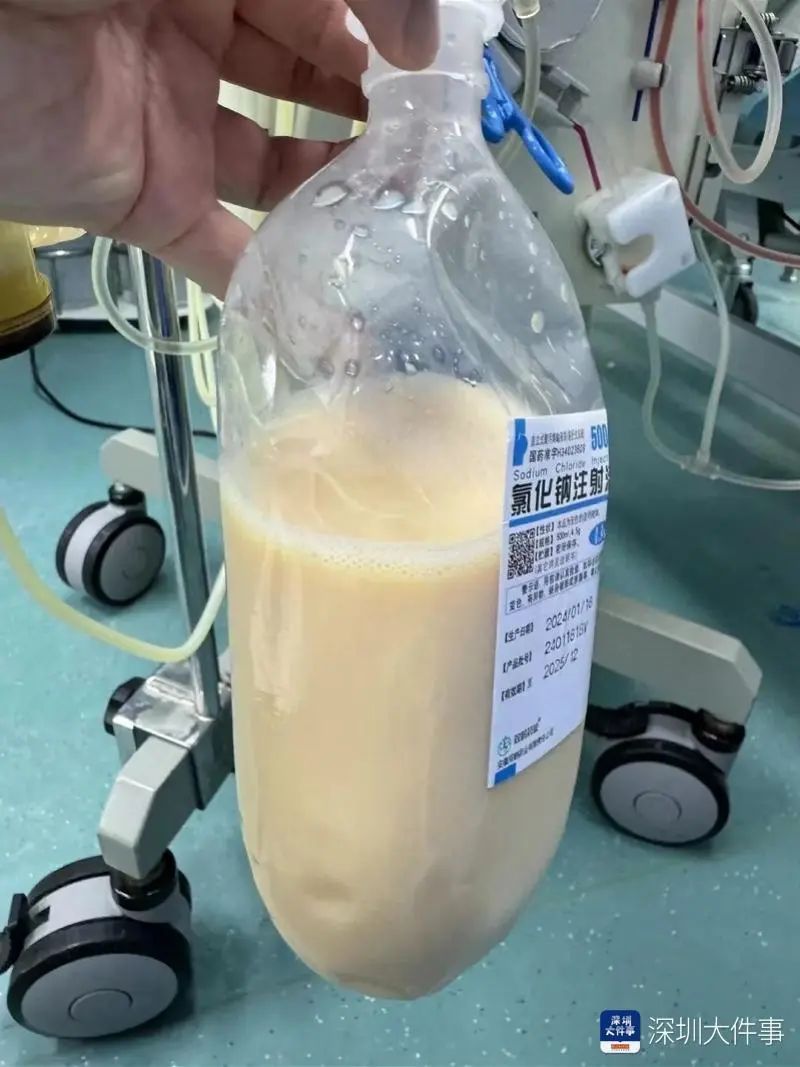 吓人！一女子体内抽出“牛奶血”，有这些习惯的人要注意