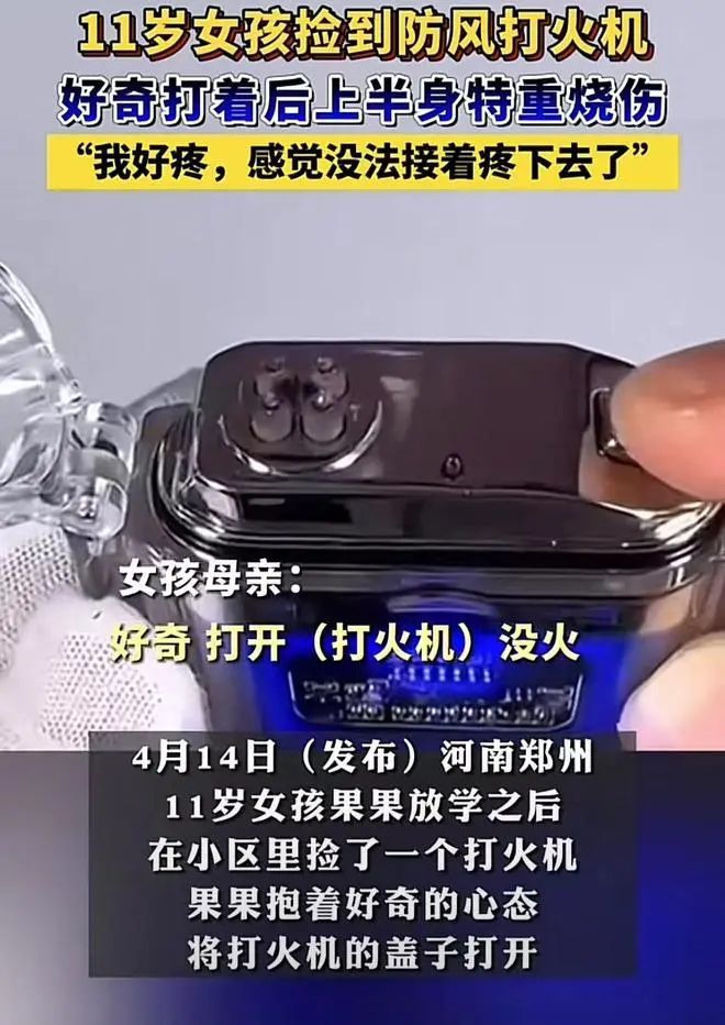 教训!11岁女孩捡个打火机致特重烧伤 教训!11岁女孩捡个打火机致特重烧伤