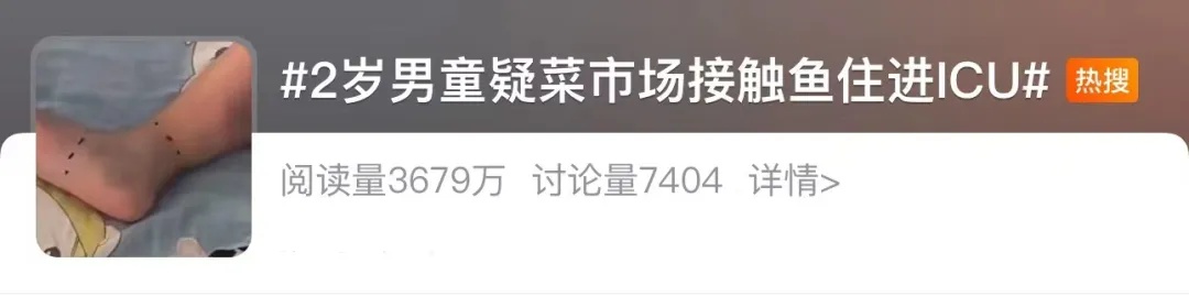 冲上热搜！2岁男童摸鱼后竟面临截肢？医生提醒→