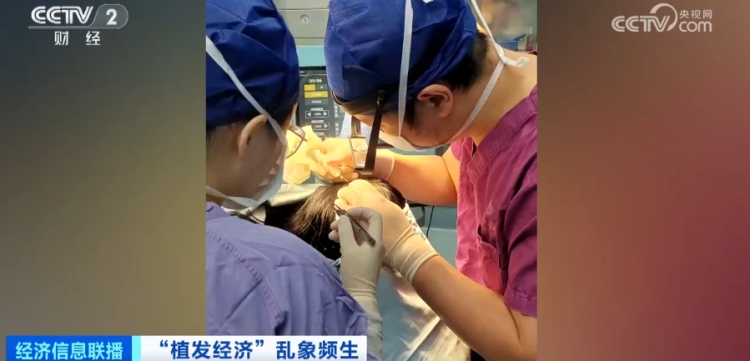 曝光了！“没长出来”“秃的”！有人欠下万元“植发贷”……