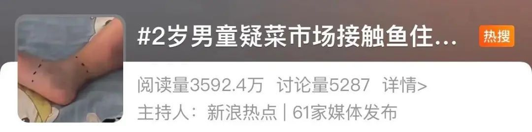 2岁男童去了趟菜场，回来后住进ICU还可能截肢！接触海鲜时这个细节别忽略