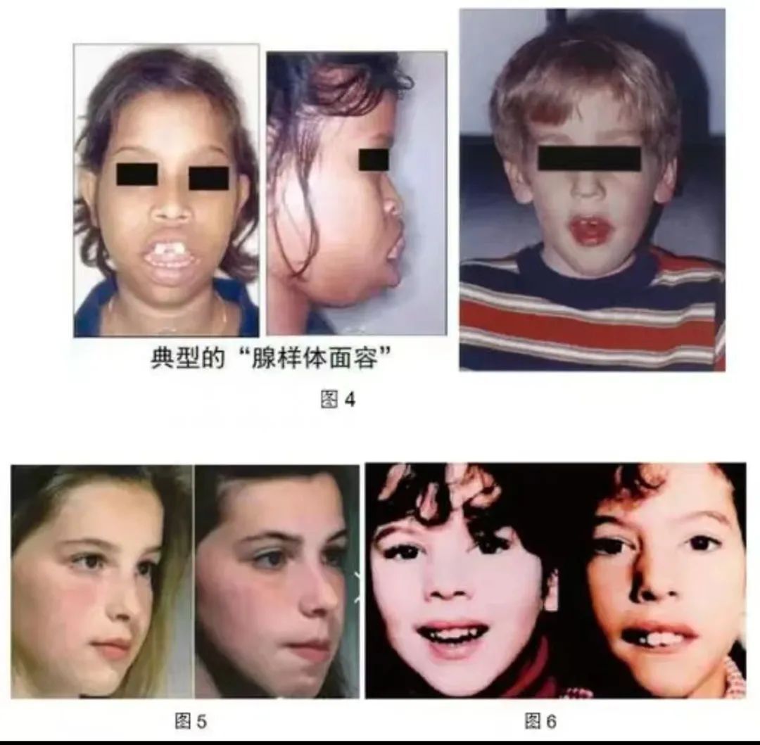一天连做19台手术,都是儿童!医生紧急提醒 一天连做19台手术,都是儿童!医生紧急提醒