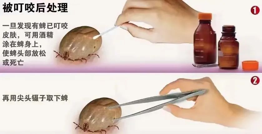 警惕！已有人因此发热不退，严重可致命！