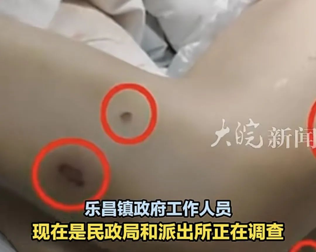 老人在养老院被捆绑浑身伤痕?曲沃警方通报:涉事护工已被拘留 老人在养老院被捆绑浑身伤痕?曲沃警方通报:涉事护工已被拘留