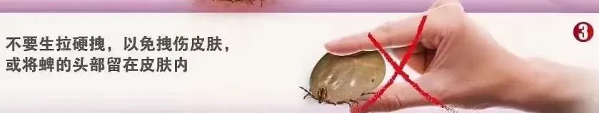 警惕！已有人因此发热不退，严重可致命！