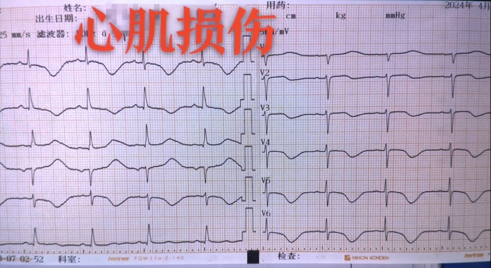 “我一点印象都没有”!一女子遭雷击后失忆…… “我一点印象都没有”!一女子遭雷击后失忆……
