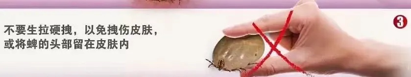 身上发现这种“小黑点”,赶紧去医院,严重可致命!近期已有多人中招 身上发现这种“小黑点”,赶紧去医院,严重可致命!近期已有多人中招