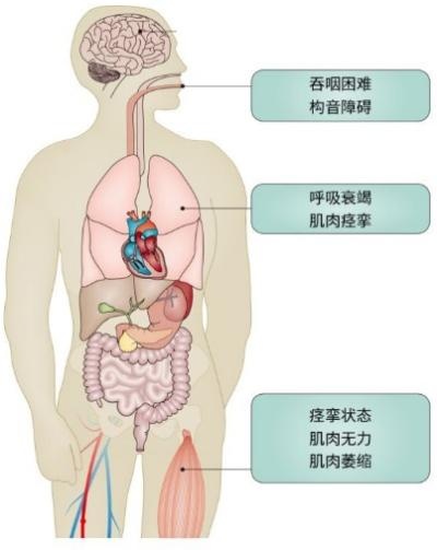 这款救命药,上海市区多家三甲医院2月起就配不到了?病人急煞…… 这款救命药,上海市区多家三甲医院2月起就配不到了?病人急煞……