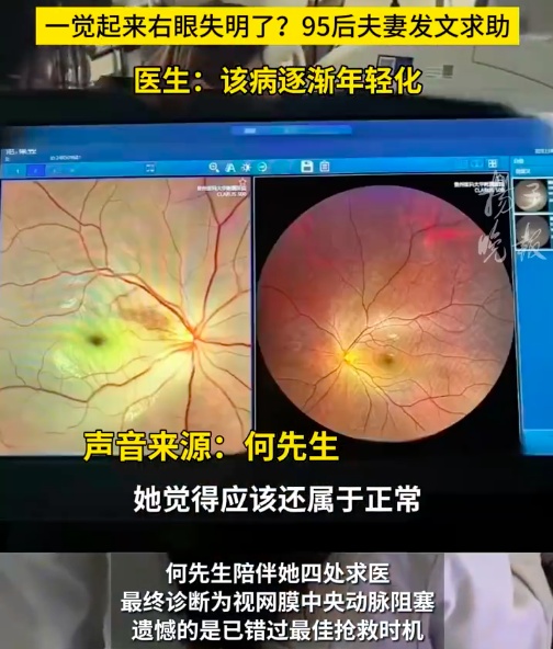 95后宝妈一觉醒来，右眼“瞎了”！医生：警惕这个先兆→