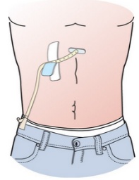 这款救命药,上海市区多家三甲医院2月起就配不到了?病人急煞…… 这款救命药,上海市区多家三甲医院2月起就配不到了?病人急煞……