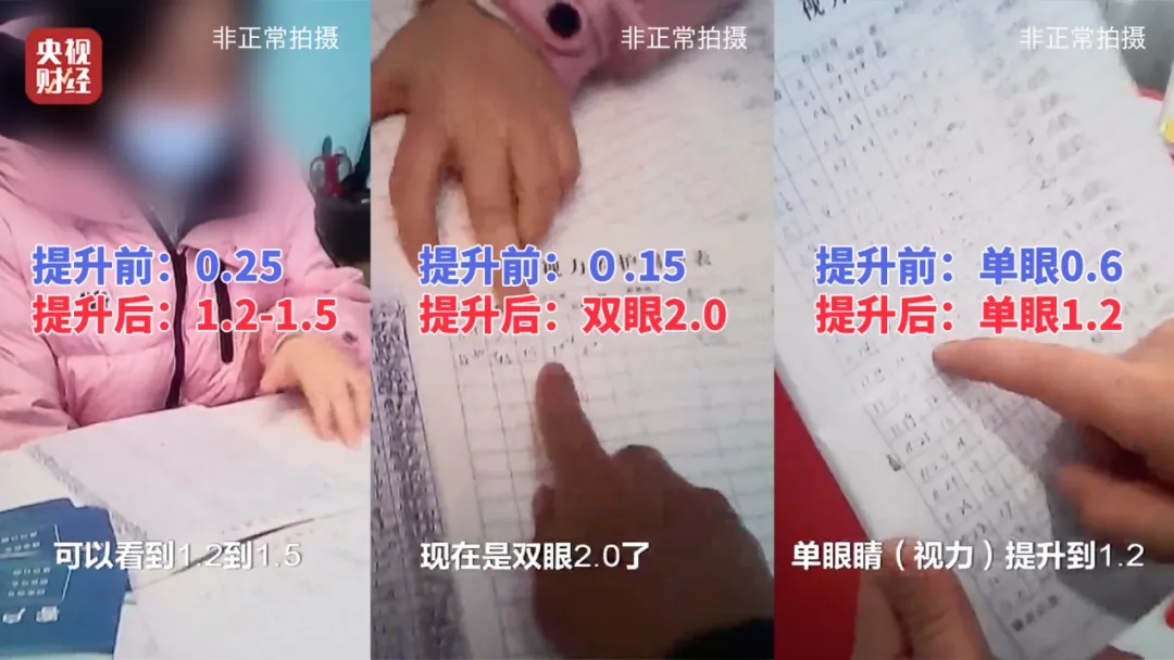 手术头灯眼镜怎么不打针、不吃药、不手术，7天摘掉近视镜？有机构“收钱收到手抽筋”……央视曝光！_https://www.jmylbn.com_新闻资讯_第3张