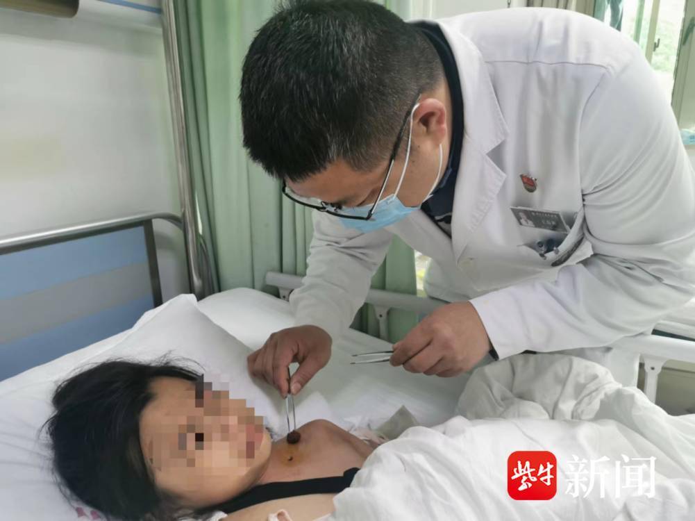 女童玩“转转椅”致锁骨骨折，医生不开刀“接骨”成功复位