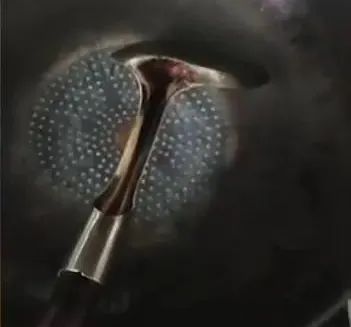 姐弟双双被烧伤!家中有孩子的一定要注意!!! 姐弟双双被烧伤!家中有孩子的一定要注意!!!