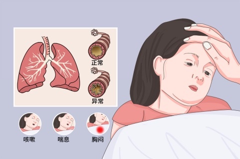 春眠不觉晓,“哮喘”知多少? 春眠不觉晓,“哮喘”知多少?