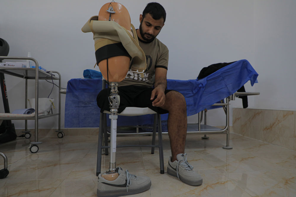 加沙医院里的被截肢患者