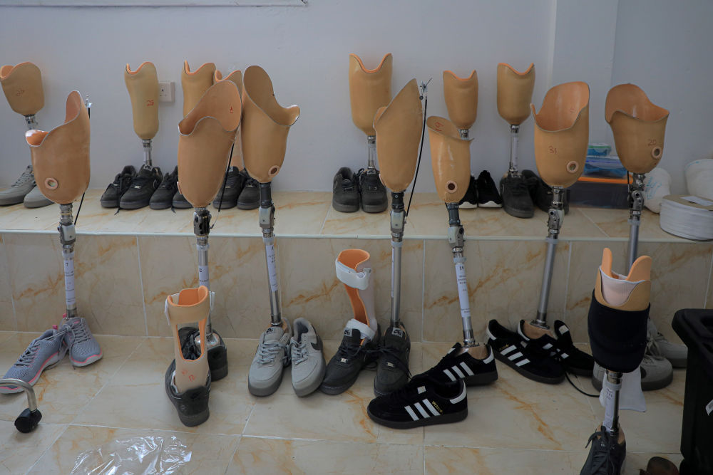 加沙医院里的被截肢患者