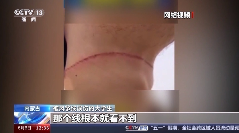 风筝线何以成“隐形刀”?平安放飞有讲究→ 风筝线何以成“隐形刀”?平安放飞有讲究→