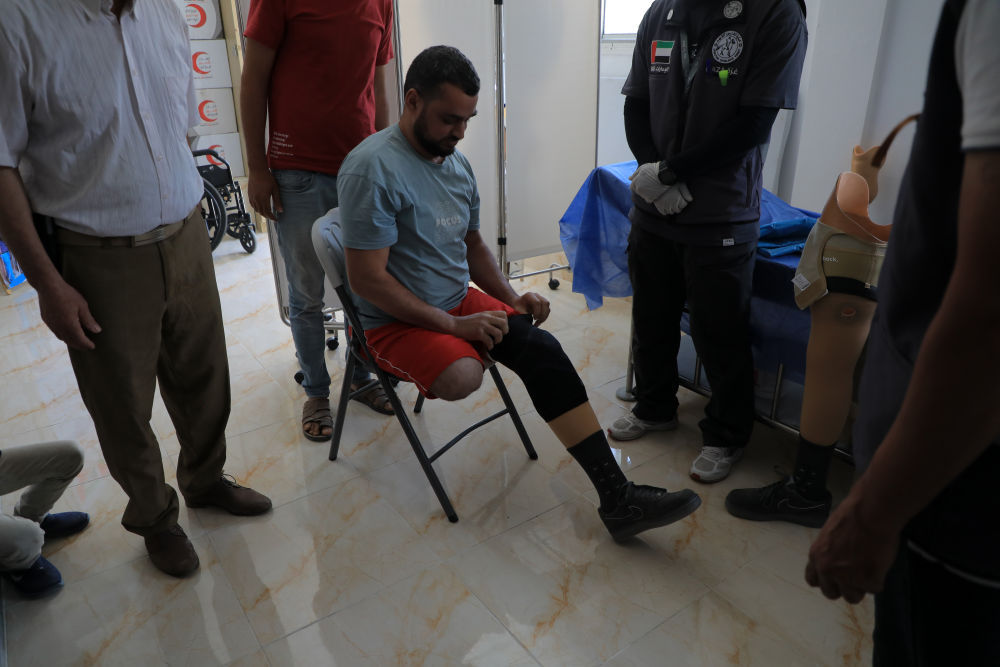 加沙医院里的被截肢患者