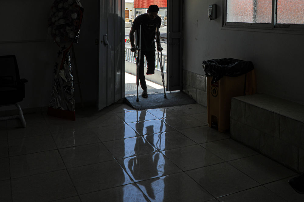 加沙医院里的被截肢患者