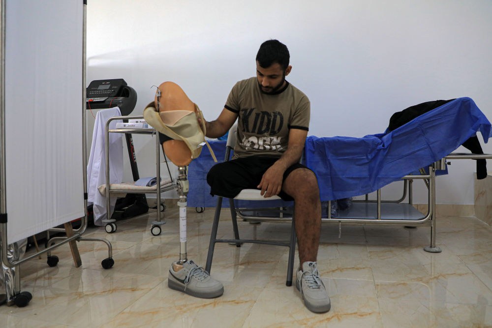 加沙医院里的被截肢患者
